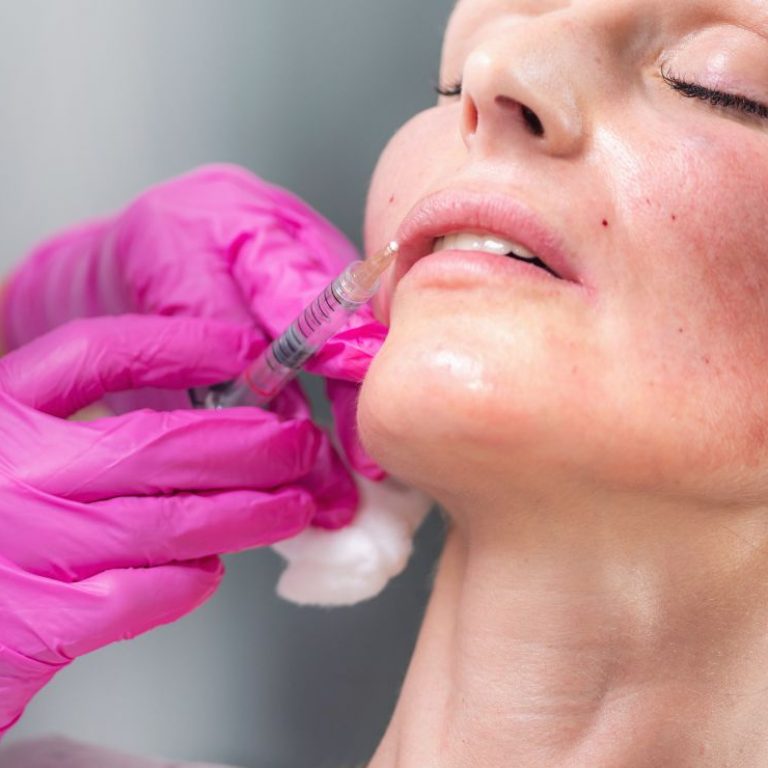 Ácido Hialurónico en Clínica Dental Dra.Pérez Garnelo en Pontevedra