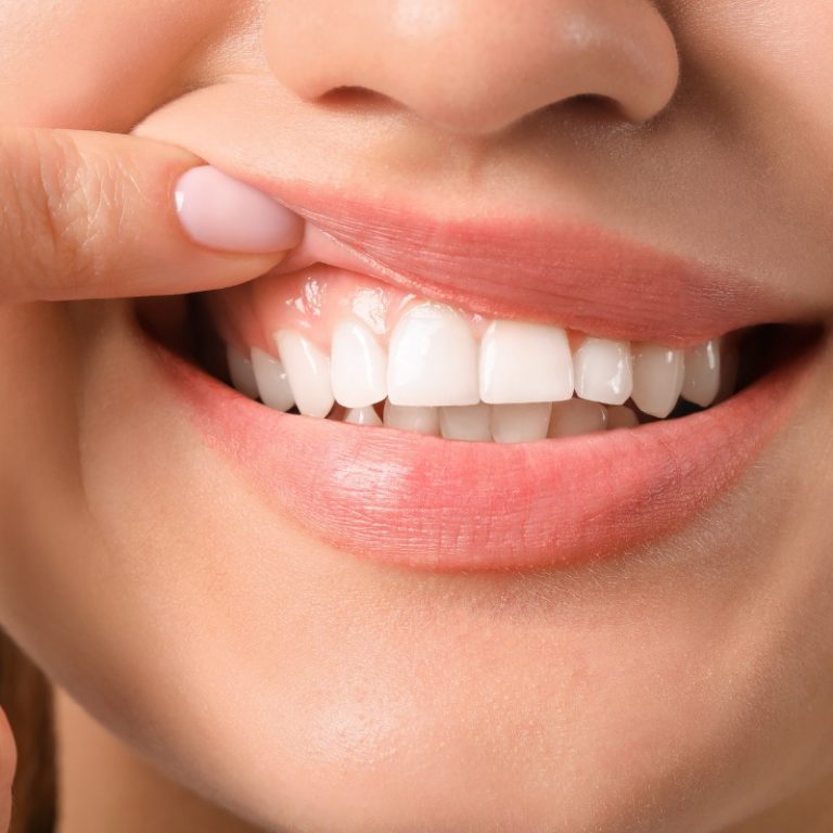 Salud de encías y periodoncia en Pontevedra en clinica dental perez garnelo en pontevedra